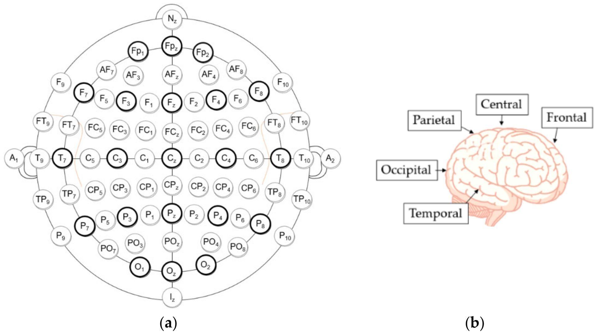 Enabling early Alzheimer's diagnosis could be possible with neural network-based visual stimuli classification systems.